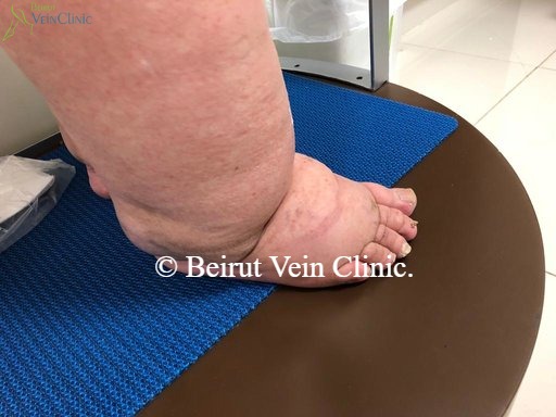 Beirut vein clinic, Lebanon